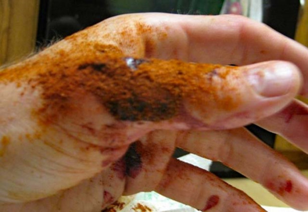 Foto - Kanamayı 10 saniyede durduruyor!