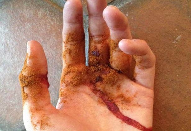 Foto - Kanamayı 10 saniyede durduruyor!