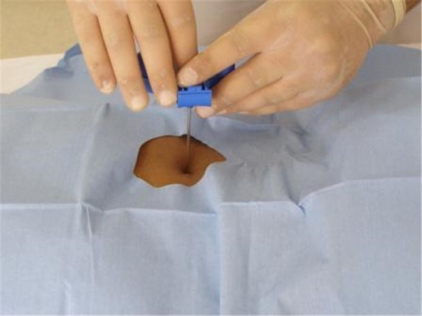 Foto - Kanser hakkında doğru bilinen yanlışlar