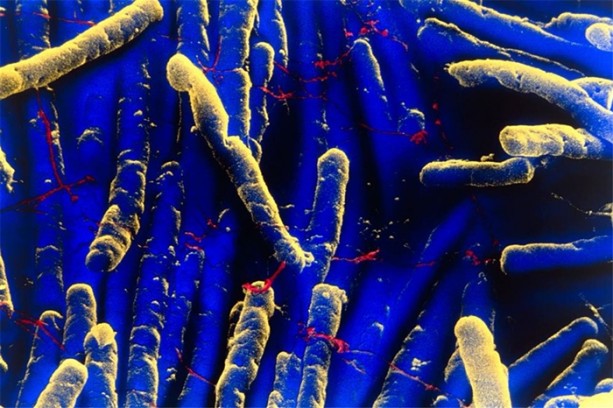 Foto - Kanser hakkında doğru bilinen yanlışlar