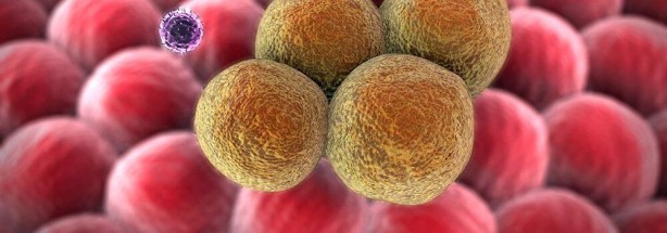 Foto - Kanser riskini azaltan sebzeler