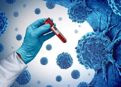 Foto - Kanser yaşı düşüyor! Uzmanlar nedenini açıkladı