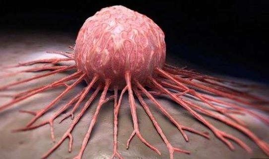 Foto - Kanser yaşı düşüyor! Uzmanlar nedenini açıkladı