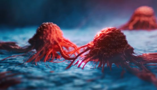 Foto - Kanser yaşı düşüyor! Uzmanlar nedenini açıkladı