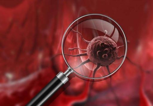 Foto - Kanser yaşı düşüyor! Uzmanlar nedenini açıkladı