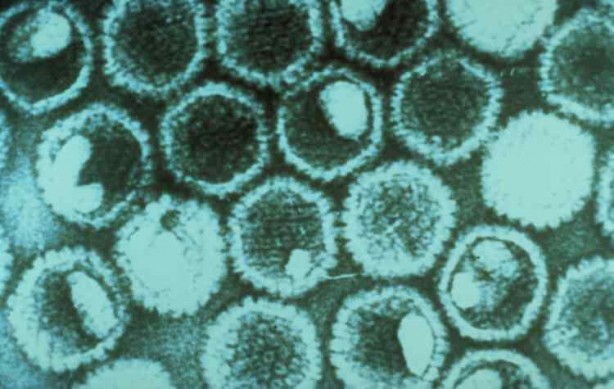 Foto - Kansere çare mi bulundu! Resmen ‘Uçuk’ devrimi yaşandı