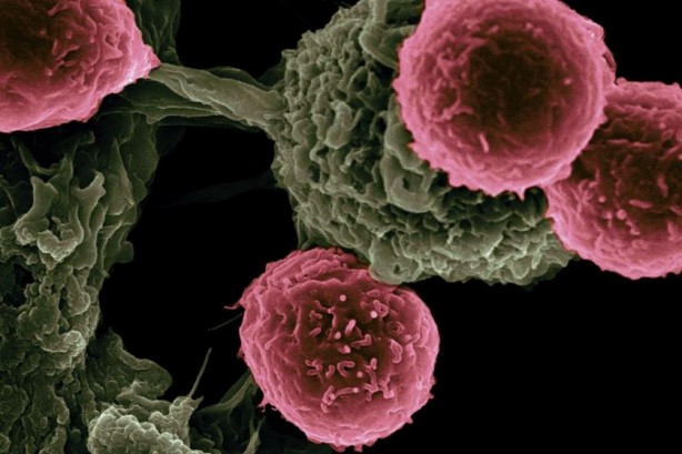 Kansere karşı koruyan en iyi 25 besin