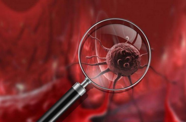 Foto - Kanseri önleyen 5 şifa dolu gıda