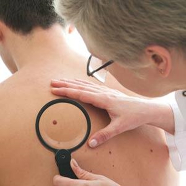 Foto - Kanserli ben nasıl anlaşılabilir?