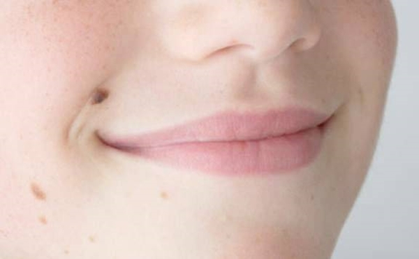 Foto - Kanserli ben nasıl anlaşılabilir?