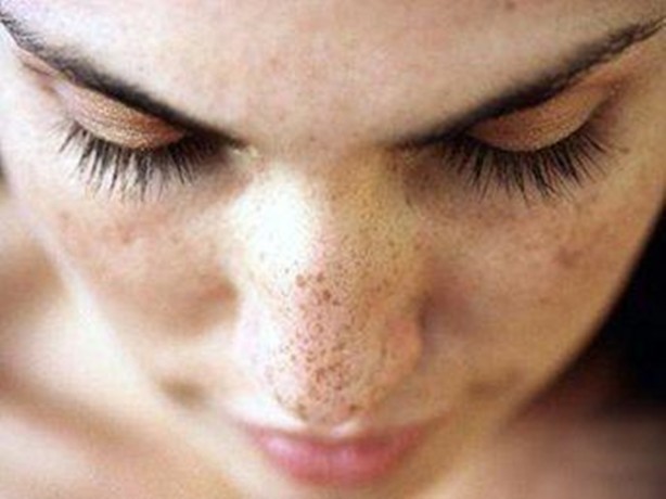 Foto - Kanserli ben nasıl anlaşılır?