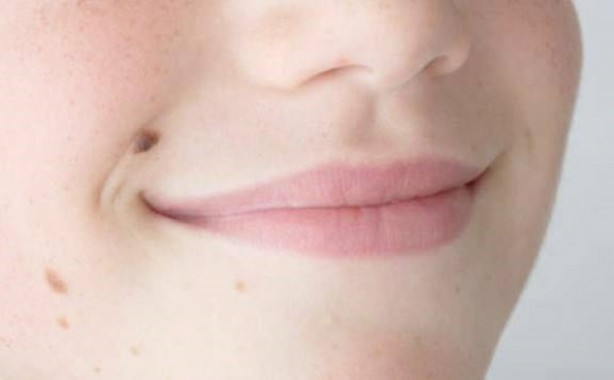 Foto - Kanserli ben nasıl anlaşılır?