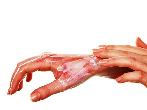 Foto - Kara aldanıp soğuk yanığı olmayın Bu belirtilere dikkat!