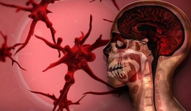 Foto - Kara Ölüm'ün en eski kurbanı bulundu! Bakın ne kadar süre dayanmış