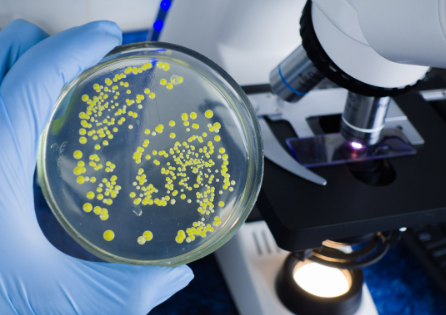 Foto - Kara Veba! Milyonları öldüren hastalığın nasıl yayıldığı bulundu