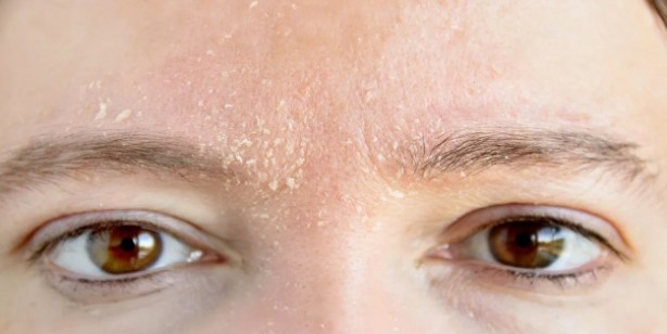 Foto - Karaciğer yağlanmasını tedavi eden sebze: Denenmiş tarif