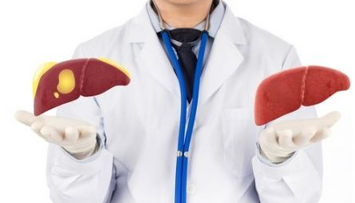 Foto - Karaciğer yağlanmasını tedavi eden sebze: Meğerse bunda saklıymış! Karaciğer yağlanması diyeti nasıl yapılır?