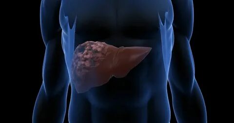 Foto - Karaciğeri mahveden beyaz zehir! Kaşık kaşık yiyoruz, damar tıkanıklığının sebebiymiş