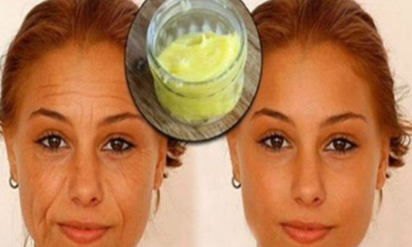 Foto - Karbonat kullanın ve 10 yaş gençleşin: Saç, cilt, akne temizliğinin bir numaralı olanı! Yapmayan bin pişman olacak