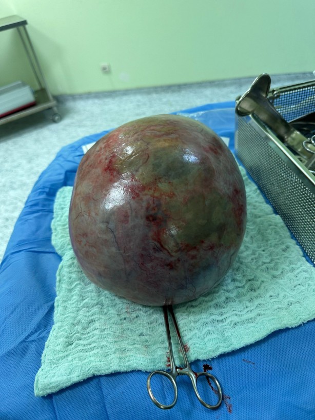 Foto - Karın ağrısı şikayetiyle doktora gitti, hayatının şokunu yaşadı: Tamı tamına 10 kilo! "Yok artık" diyeceksiniz