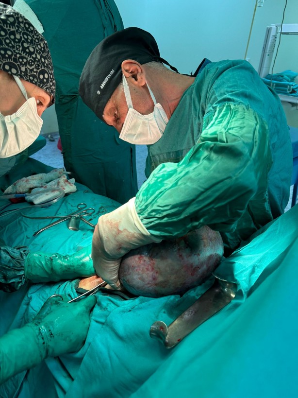 Foto - Karın ağrısı şikayetiyle doktora gitti, hayatının şokunu yaşadı: Tamı tamına 10 kilo! "Yok artık" diyeceksiniz
