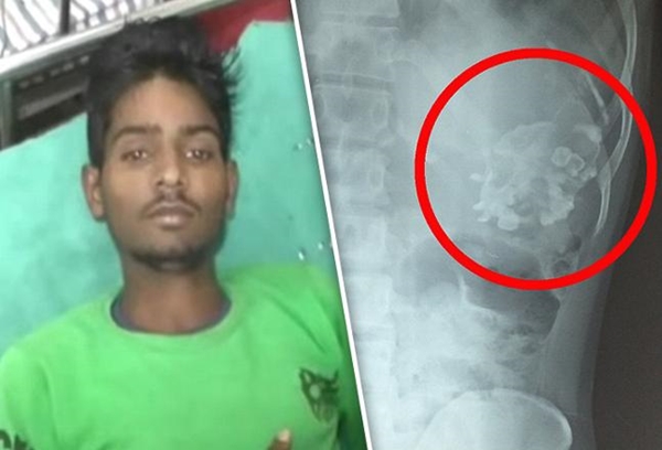 Foto - Karnından çıkana kimse inanamadı!