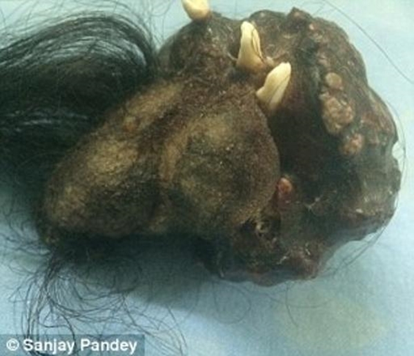 Foto - Karnından çıkana kimse inanamadı!