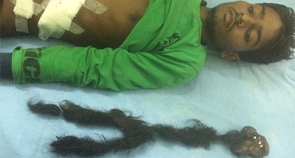 Foto - Karnından çıkana kimse inanamadı!