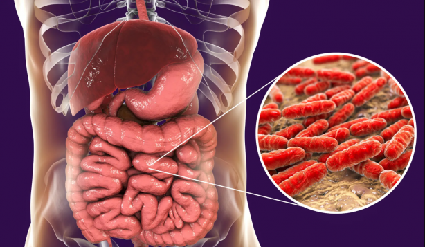 Foto - Karpuz tüketenler dikkat! Bu iki meyveyi birlikte sakın yemeyin...