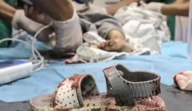 Foto - Katil İsrail Gazze'de soykırıma devam ediyor! Dünyanın gözü önünde insanlık ayaklar altına alınıyor