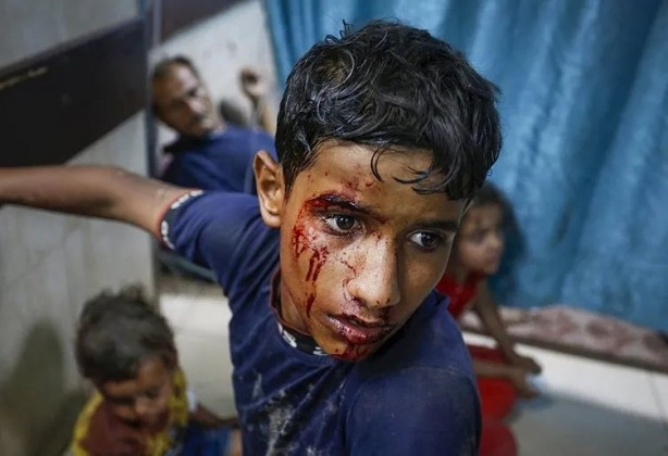 Foto - Katil İsrail insanları bu silahlarla katlediyor!