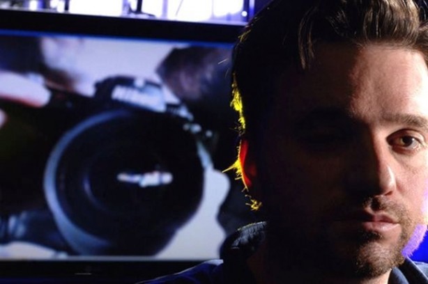 Foto - Kaybettiği gözünün yerine bakın ne yaptı!