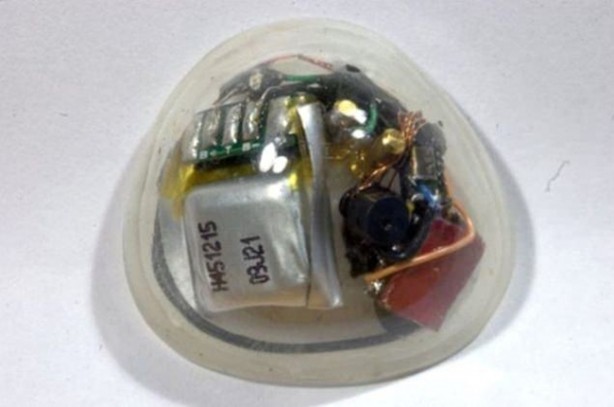 Foto - Kaybettiği gözünün yerine bakın ne yaptı!