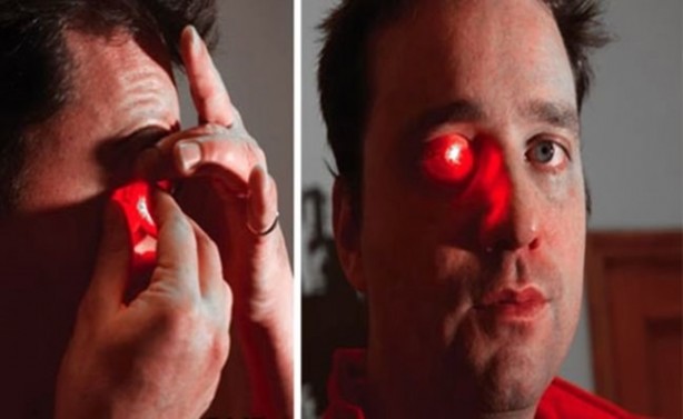 Foto - Kaybettiği gözünün yerine bakın ne yaptı!