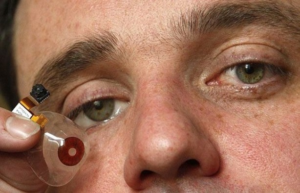 Foto - Kaybettiği gözünün yerine bakın ne yaptı!