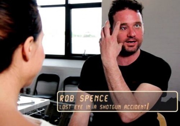 Foto - Kaybettiği gözünün yerine bakın ne yaptı!