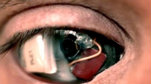 Foto - Kaybettiği gözünün yerine bakın ne yaptı!