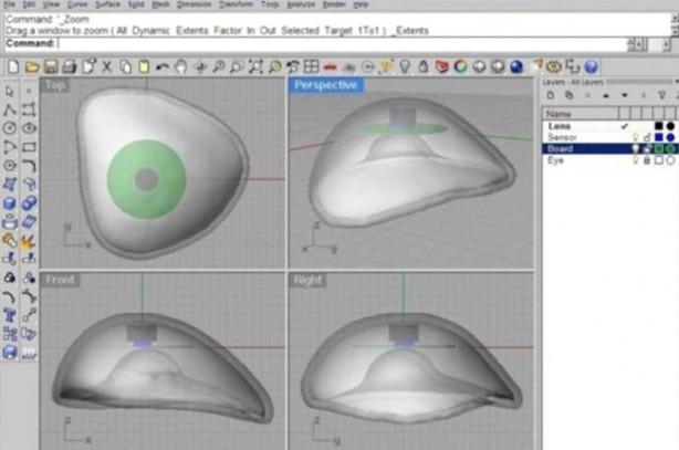 Foto - Kaybettiği gözünün yerine bakın ne yaptı!