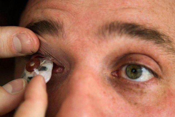 Foto - Kaybettiği gözünün yerine bakın ne yaptı!