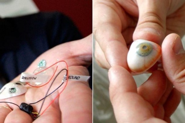 Foto - Kaybettiği gözünün yerine bakın ne yaptı!