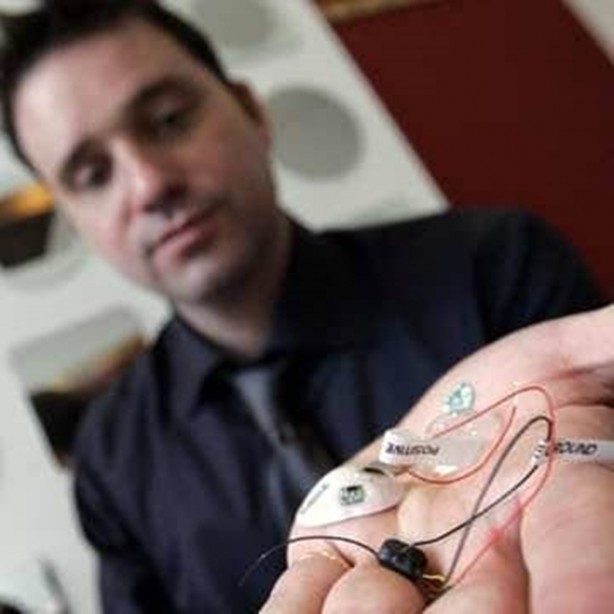 Foto - Kaybettiği gözünün yerine bakın ne yaptı!