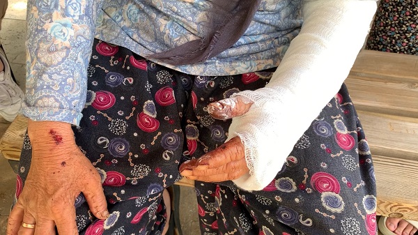 Foto - Keçilerini otlatmaya giderken kanlar içinde kaldı