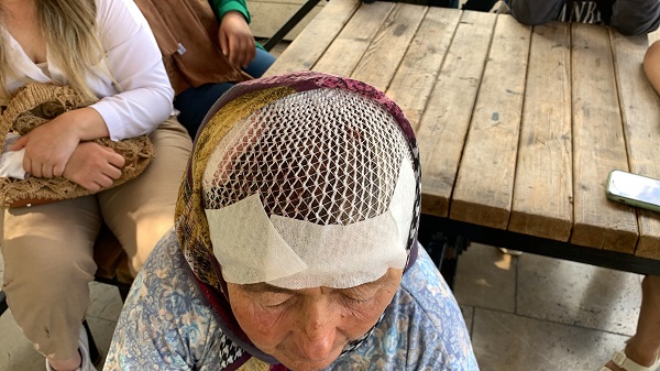 Foto - Keçilerini otlatmaya giderken kanlar içinde kaldı