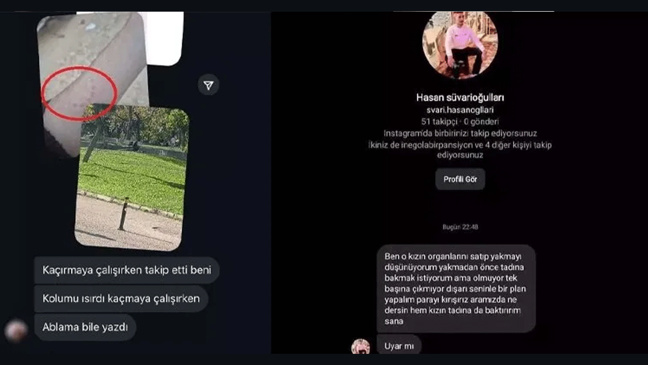 Foto - Keleşle takip etti, kolunu ısırdı, tehditler savurdu! "Organlarını yakacağım"