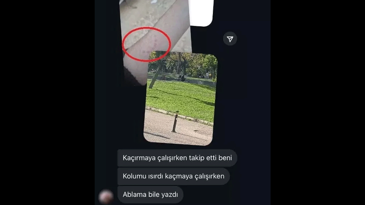 Foto - Keleşle takip etti, kolunu ısırdı, tehditler savurdu! "Organlarını yakacağım"