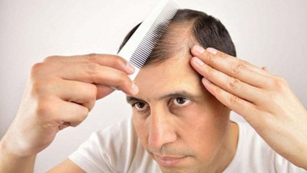 Kelliğin çözümü onda gizli! Herkesin evinde var! Suyla karıştırıp sürün! Gözlerinize inanamayacaksınız