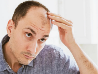 Foto - Kellik tedavisi için sarımsak kürleri: İşimize yarar mı? Saçı dökülen ve kepek sorunu yaşayanların dikkatine