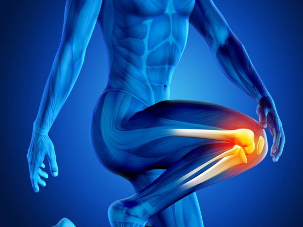 Foto - Kemik erimesine deva olan kür