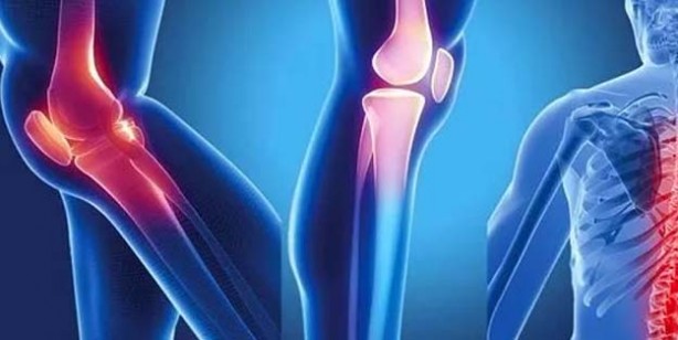 Foto - Kemik erimesine deva olan kür