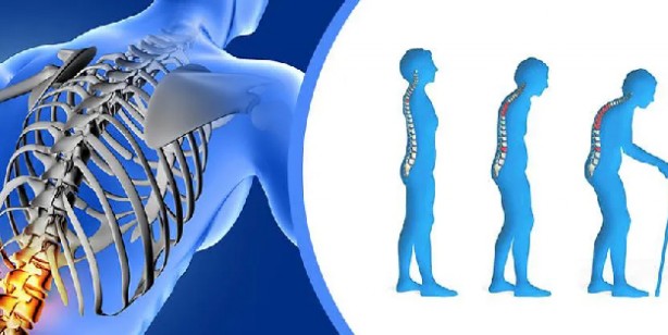 Kemik erimesine ne iyi gelir?